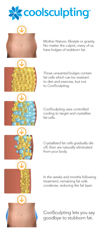 CoolSculpting